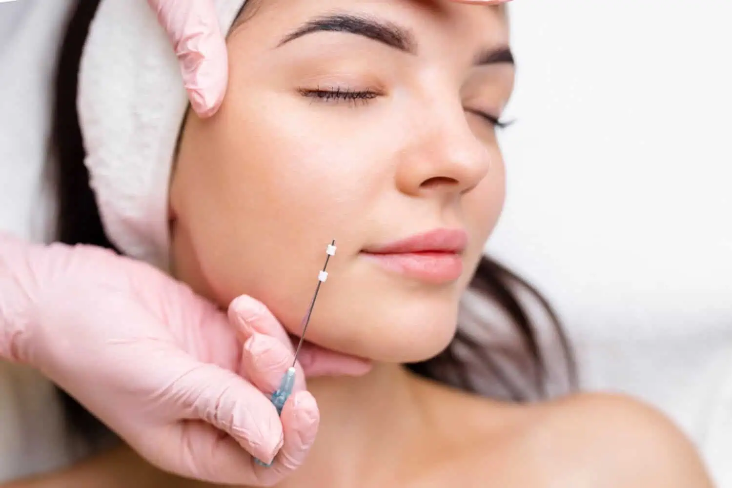 Sei Tu Bella Aesthetics MINT™ Thread Lifts Treatments in Tampa, FL