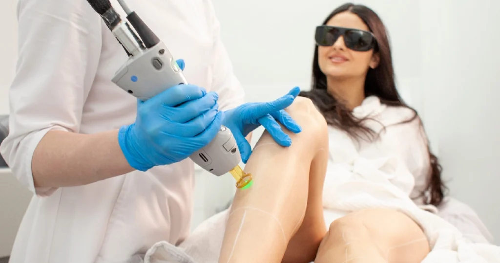 Laser hair removal treatment in progress.