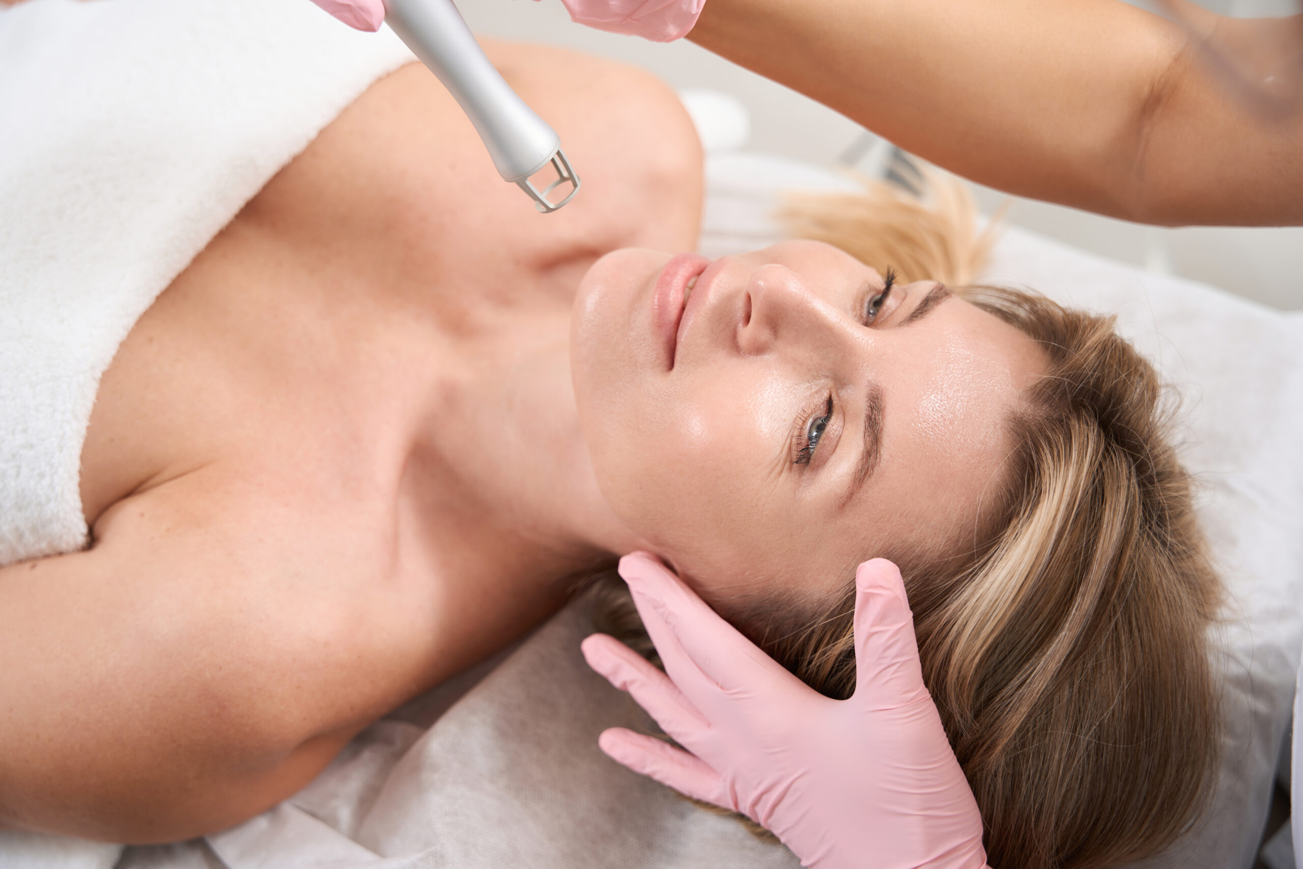 CO2 Laser Resurfacing