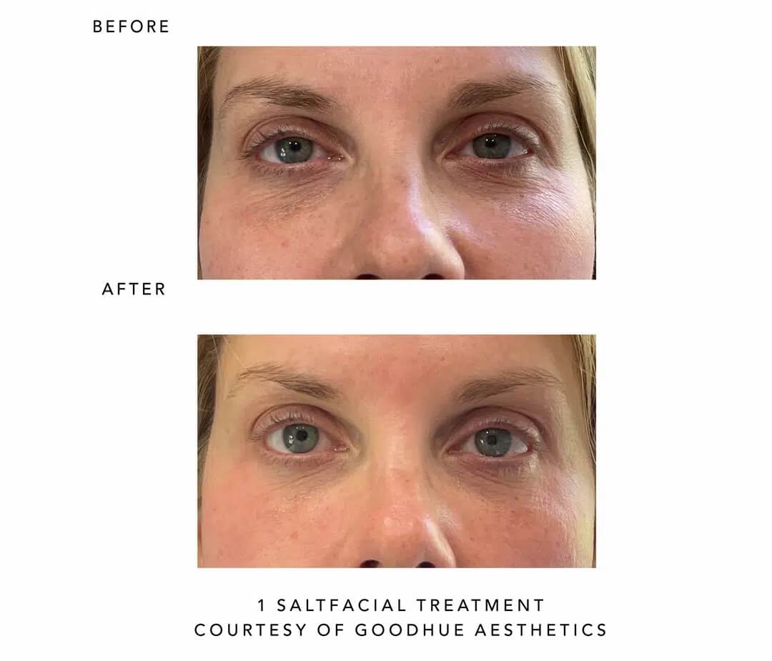 Before and After images | Sei tu bella aesthetics