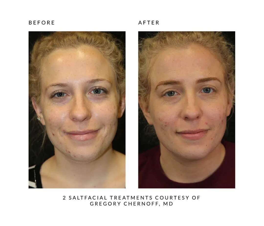 Before and After images | Sei tu bella aesthetics