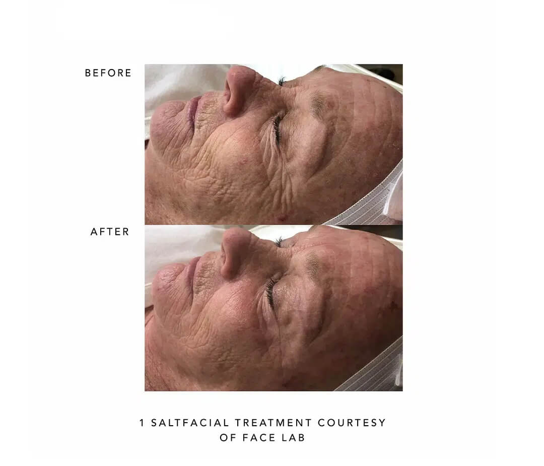 Before and After images | Sei tu bella aesthetics