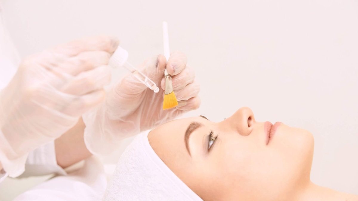5 Amazing Chemical Peel Benefits You May Have Not Known