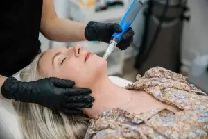 Microneedling With Skinpen Prp at New Port Richey